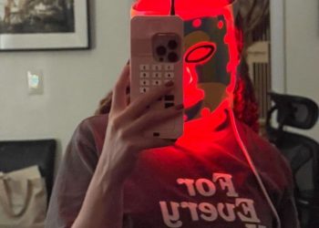 What It’s Like To Get Fillers For Dark Circles