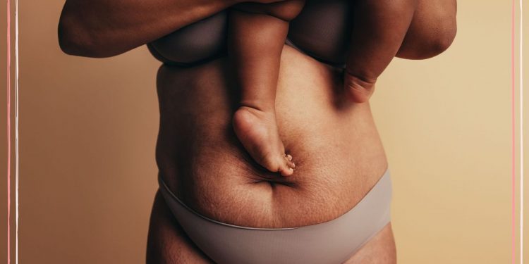 Understanding your postpartum belly – what doctors and midwives want you to know