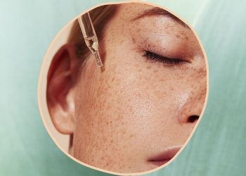 If you try one beauty product, make it a dark spot treatment