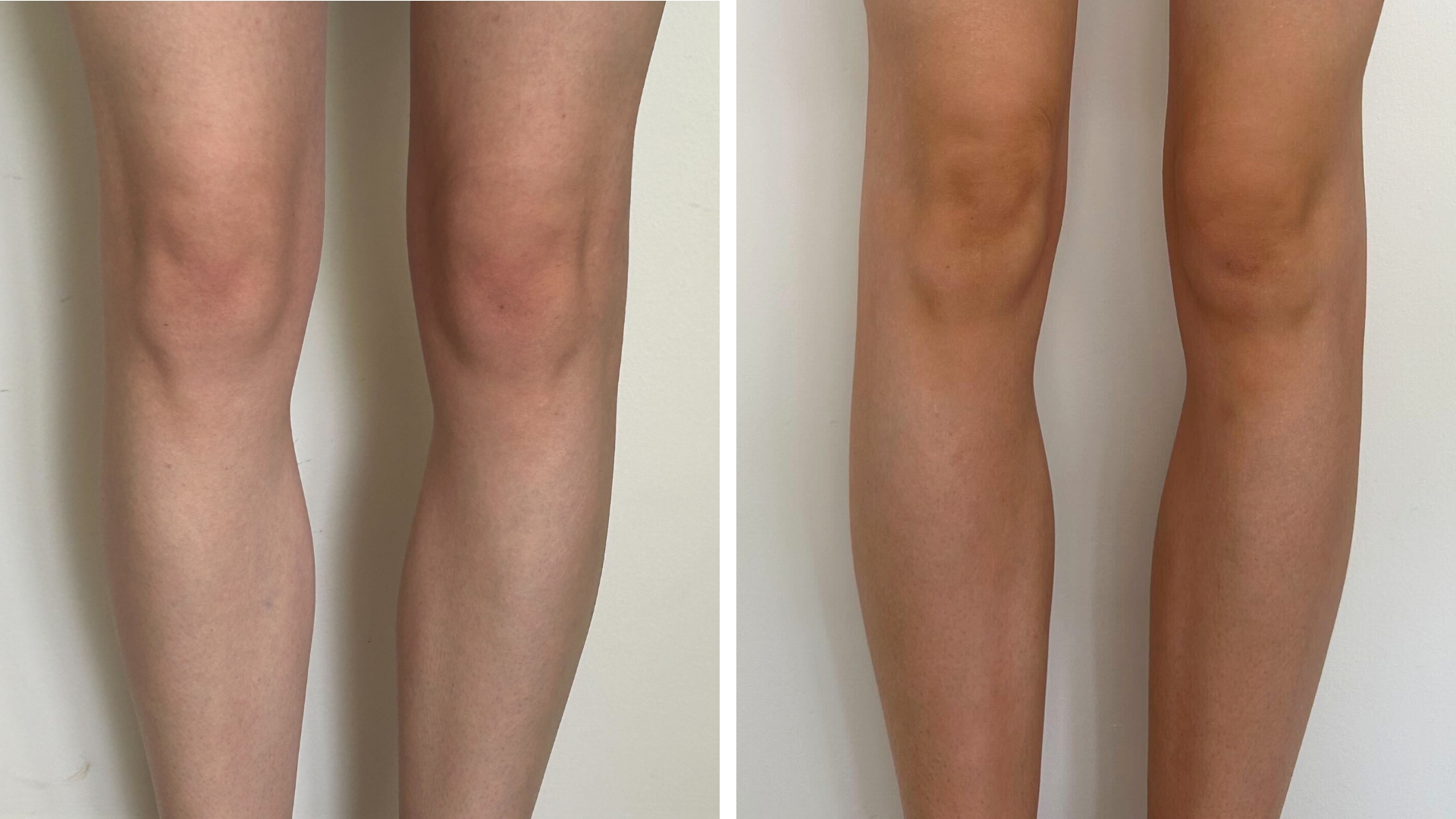 Collage of pictures showing before and after Sennen Prickett used the Isle of Paradise Gradual Tan on her legs