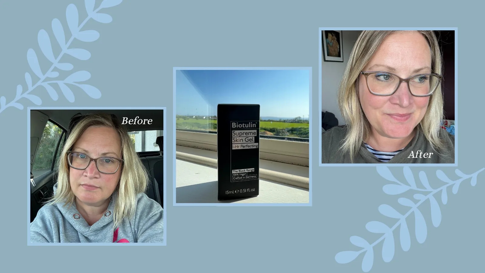 Shopping Editor Heidi Scrimgeour puts the Biotulin Skin Gel to the test